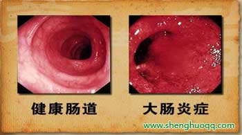 肠道内部图