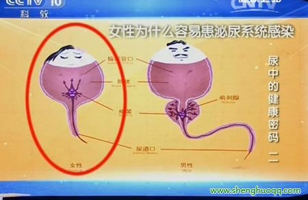 女性泌尿系感染