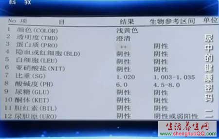 尿常规化验单www.caidaoke.com