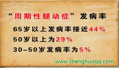 周期性腿动症