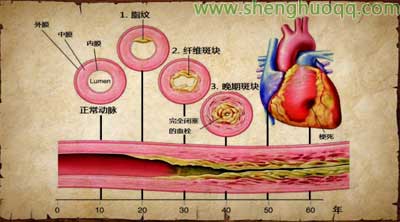 心脏血管结构图2