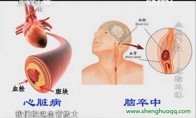 高血压对心脏和大脑的影响