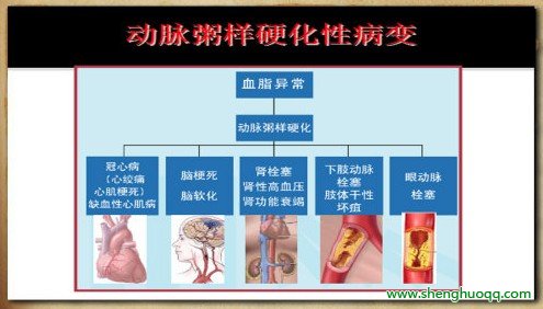 动脉粥样硬化性病变过程