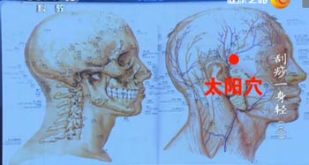 太阳穴