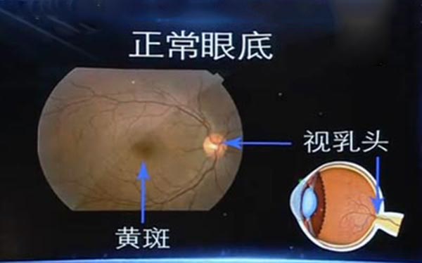 眼底结构