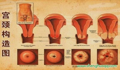宫颈构造图