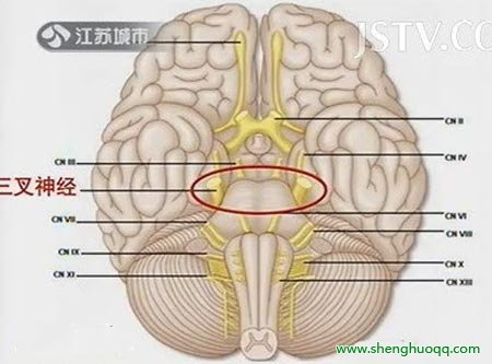 三叉神经在哪里