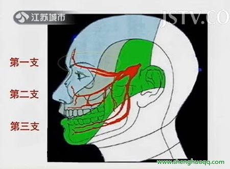 三叉神经痛原因