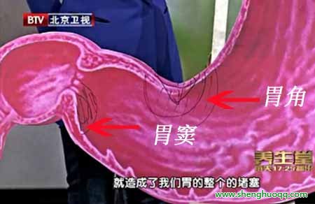 胃角与胃窦的位置