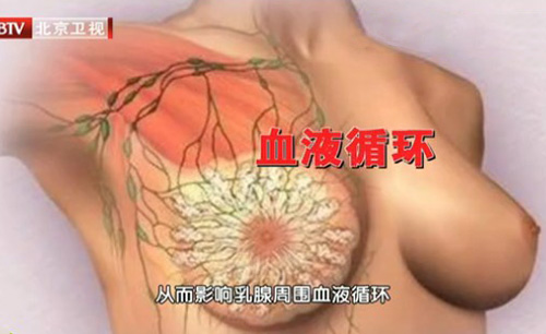 穿内衣与乳腺癌