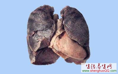 肺癌www.caidaoke.com