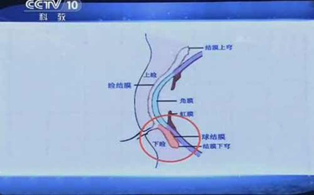 眼睛解剖结构