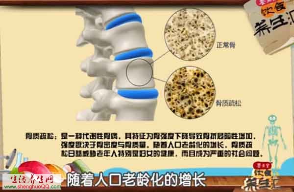 容易被忽视的骨质疏松