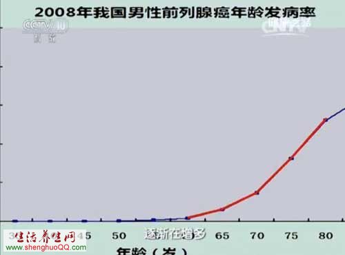 前列腺癌发病与年龄