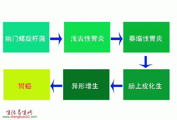 幽门螺旋杆菌与胃癌