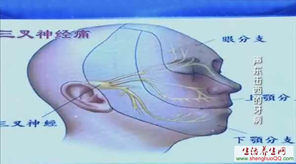 三叉神经经的位置