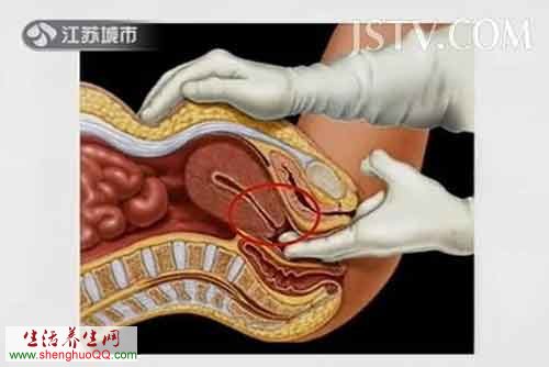 （宫颈长什么样-图2）