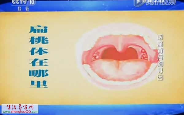 扁桃体的位置