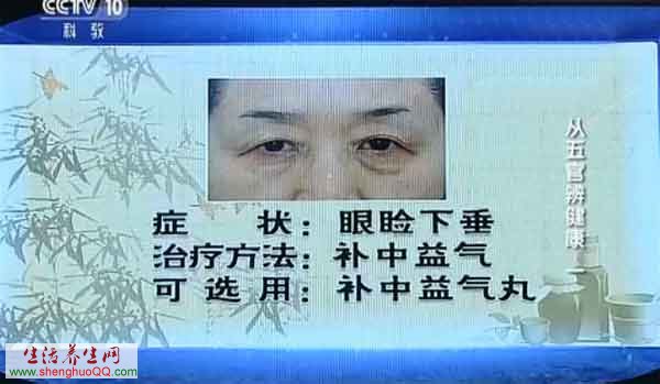 眼睑下垂