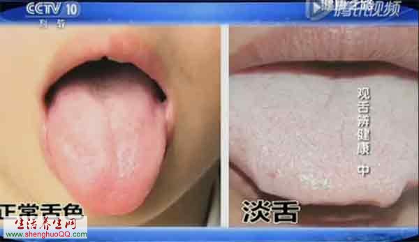 舌色偏淡
