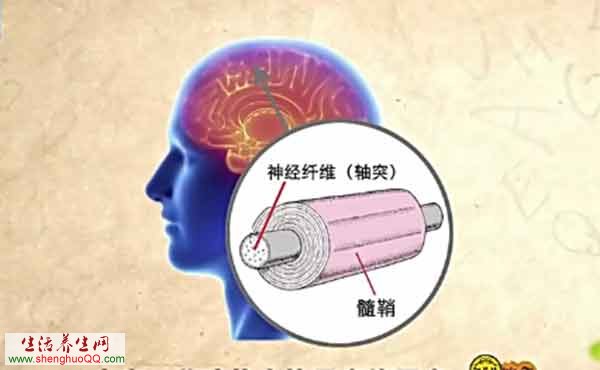 多发性更化症