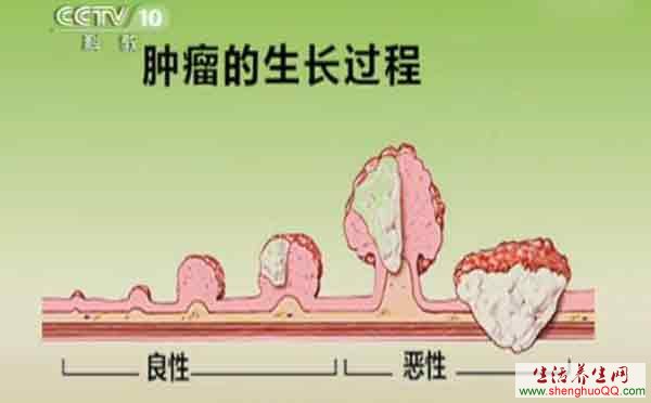 肿瘤的生长过程