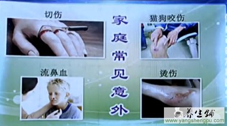 家庭中常见的意外
