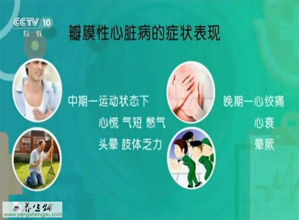 瓣膜性心脏病的症状