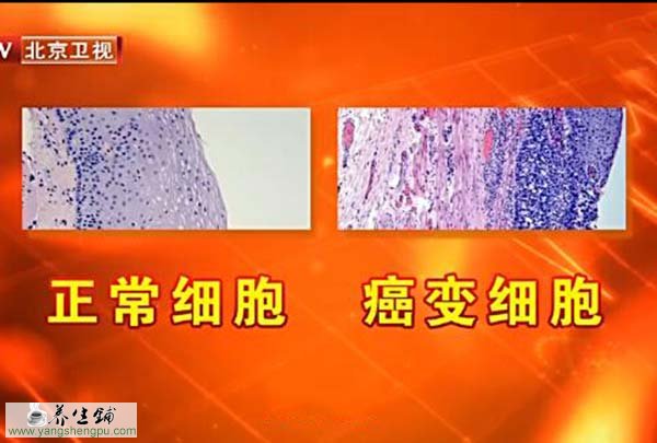 正常细胞与癌细胞