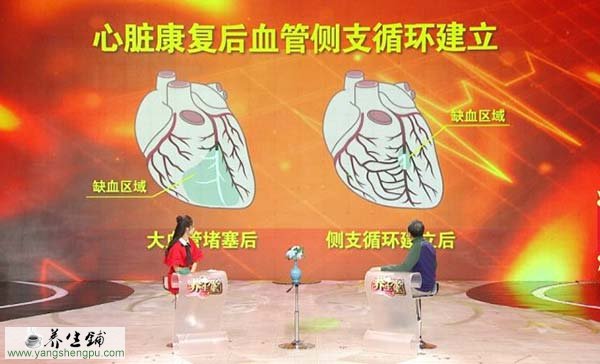 心脏缺血