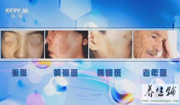 脸上长斑