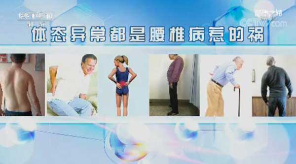 腰椎病惹的祸