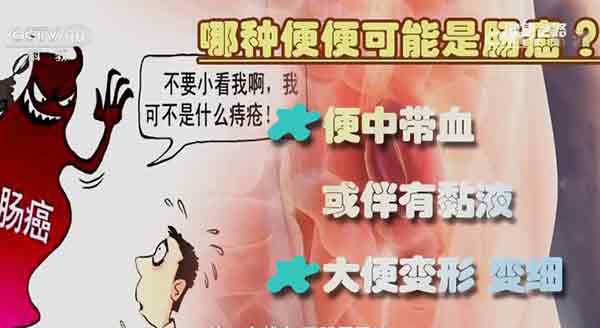 大便异常