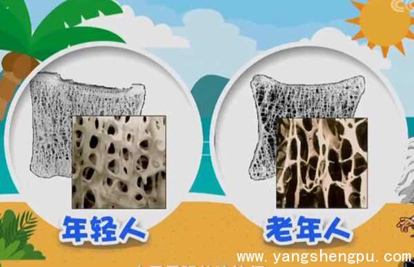 骨质疏松