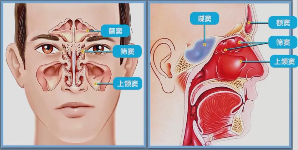 鼻窦炎位置图片图片