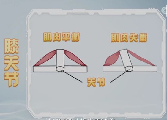 膝关节失衡的示意图