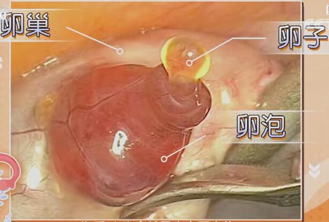 真实卵巢、卵子、卵泡结构图