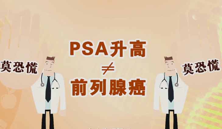 psa检查是什么意思