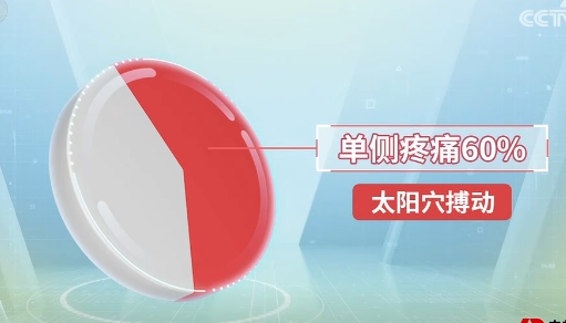 偏头痛
