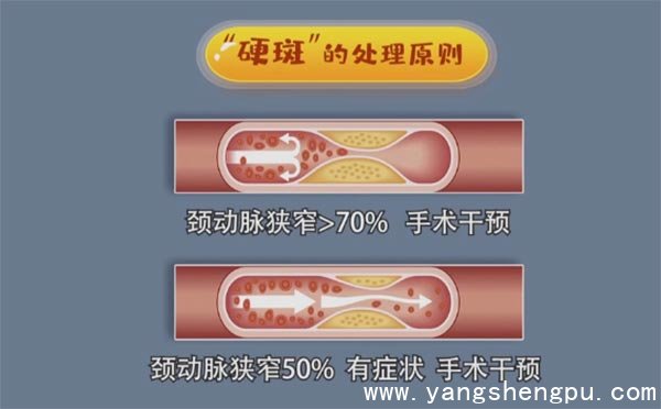 硬斑的处理原则