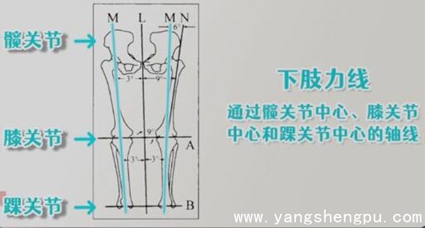 下肢力线图