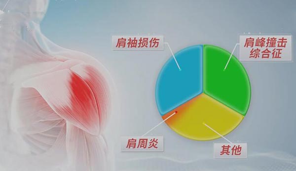 肩膀酸痛